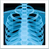 x-ray